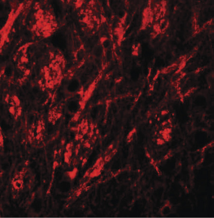 Immunofluorescence of ZIP9 in human brain tissue with ZIP9 antibody at 20 ug/ml.