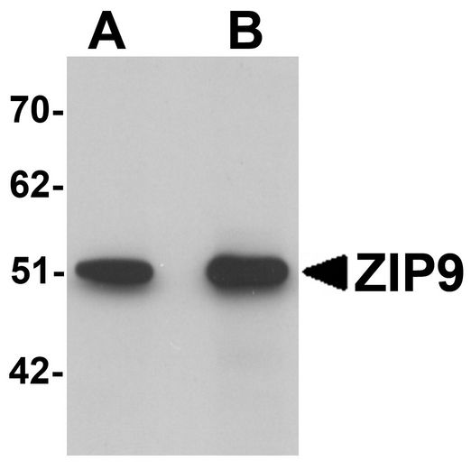Western blot analysis of ZIP9 in HepG2 cell lysate with ZIP9 antibody at (A) 1 and (B) 2 ug/ml.