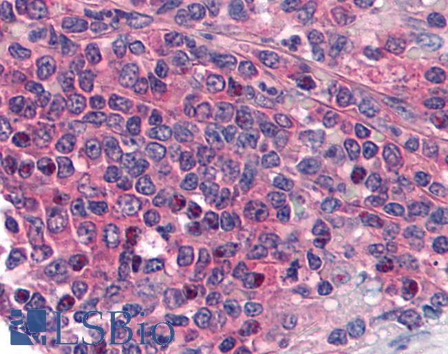 Anti-PTGER1 / EP1 antibody IHC of human spleen. Immunohistochemistry of formalin-fixed, paraffin-embedded tissue after heat-induced antigen retrieval. Antibody LS-B1744 concentration 5 ug/ml.