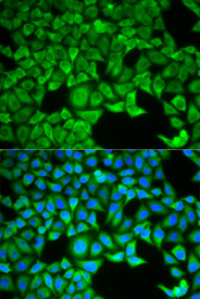 Immunofluorescence analysis of HeLa cell using SLC3A1 antibody. Blue: DAPI for nuclear staining.