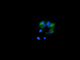 Anti-PROSC mouse monoclonal antibody immunofluorescent staining of COS7 cells transiently transfected by pCMV6-ENTRY PROSC.