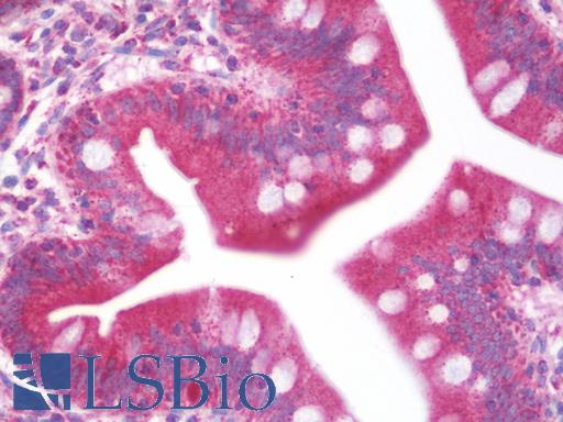 Anti-SLC40A1 / Ferroportin-1 antibody IHC staining of human small intestine. Immunohistochemistry of formalin-fixed, paraffin-embedded tissue after heat-induced antigen retrieval.