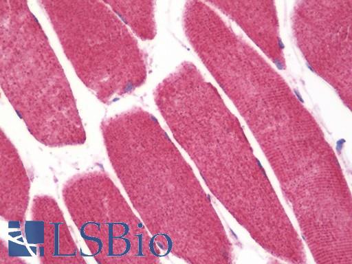 Anti-SLC40A1 / Ferroportin-1 antibody IHC staining of human skeletal muscle. Immunohistochemistry of formalin-fixed, paraffin-embedded tissue after heat-induced antigen retrieval. Antibody LS-B10438 concentration 5 ug/ml.