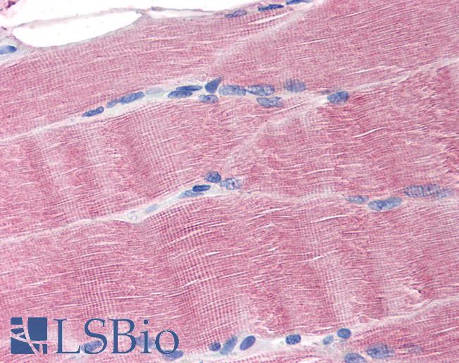 Anti-SLC40A1 antibody IHC of human skeletal muscle. Immunohistochemistry of formalin-fixed, paraffin-embedded tissue after heat-induced antigen retrieval. Antibody LS-B1836 concentration 20 ug/ml.