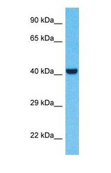Western blot of PTGER1 Antibody with human MCF7 Whole Cell lysate.