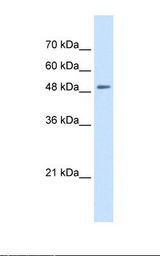 Jurkat cell lysate. Antibody concentration: 0.25 ug/ml. Gel concentration: 12%.