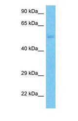 Western blot of SLC43A3 Antibody with human Jurkat Whole Cell lysate.