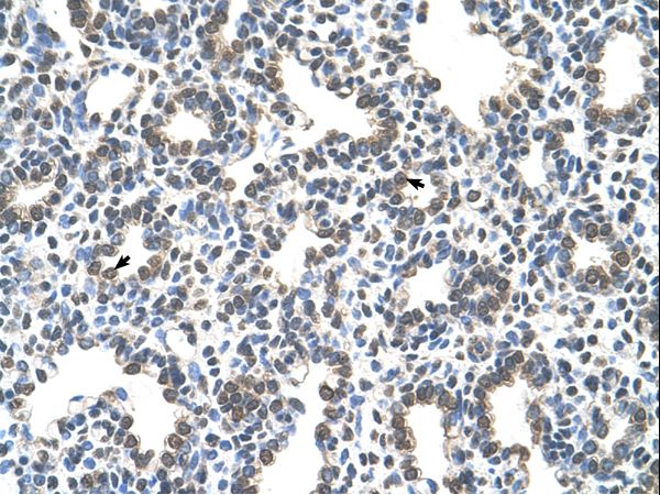 SLC43A3 antibody LS-C40433 was used in IHC to stain formalin-fixed, paraffin-embedded human lung.