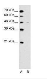 A: Marker, B: Jurkat Cell Lysate