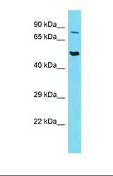 Western blot of Human Thymus Tumor. SLC44A2 antibody dilution 1.0 ug/ml.