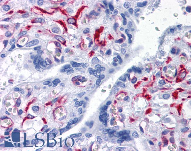 Anti-SLC44A2 antibody IHC of human placenta. Immunohistochemistry of formalin-fixed, paraffin-embedded tissue after heat-induced antigen retrieval. Antibody LS-B4532 concentration 10 ug/ml.