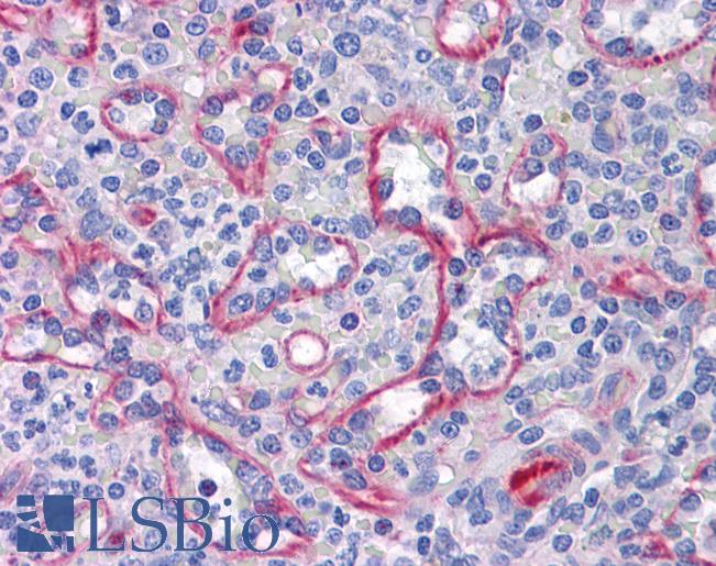 Anti-SLC44A2 antibody IHC of human spleen. Immunohistochemistry of formalin-fixed, paraffin-embedded tissue after heat-induced antigen retrieval. Antibody LS-B4532 concentration 10 ug/ml.
