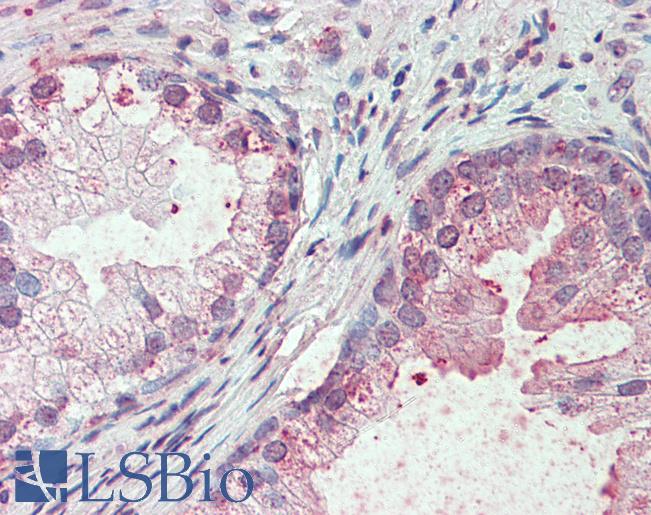 Anti-SLC44A2 antibody LS-A9125 IHC of human prostate. Immunohistochemistry of formalin-fixed, paraffin-embedded tissue after heat-induced antigen retrieval.