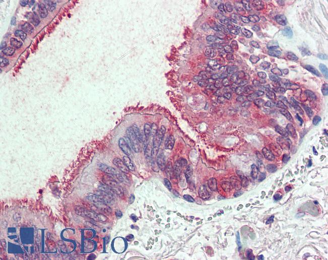 Anti-SLC44A2 antibody LS-A9130 IHC of human lung, respiratory epithelium. Immunohistochemistry of formalin-fixed, paraffin-embedded tissue after heat-induced antigen retrieval.