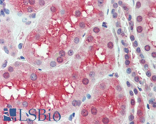 Anti-SLC44A2 antibody LS-A9130 IHC of human kidney. Immunohistochemistry of formalin-fixed, paraffin-embedded tissue after heat-induced antigen retrieval.