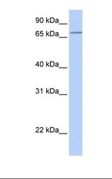 Hela cell lysate. Antibody concentration: 1.0 ug/ml. Gel concentration: 12%.