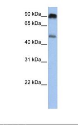 Jurkat cell lysate. Antibody concentration: 1.0 ug/ml. Gel concentration: 12%.