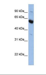 HepG2 cell lysate. Antibody concentration: 1.0 ug/ml. Gel concentration: 12%.