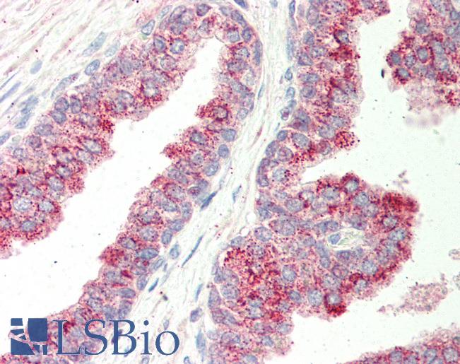 Anti-SLC45A3 / Prostein antibody IHC of human prostate. Immunohistochemistry of formalin-fixed, paraffin-embedded tissue after heat-induced antigen retrieval. Antibody LS-B309 concentration 5 ug/ml.