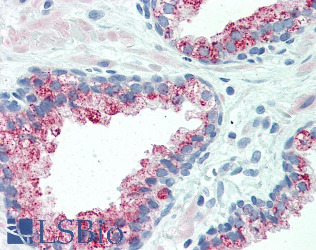 Anti-SLC45A3 / Prostein antibody IHC of human prostate. Immunohistochemistry of formalin-fixed, paraffin-embedded tissue after heat-induced antigen retrieval. Antibody LS-B3288 concentration 5 ug/ml.