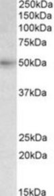 SLC46A1 antibody (0.3 ug/ml) staining of Human Liver lysate (35 ug protein/ml in RIPA buffer). Primary incubation was 1 hour. Detected by chemiluminescence.