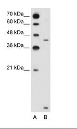 A: Marker, B: Jurkat Cell Lysate