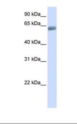 Fetal lung lysate. Antibody concentration: 1.0 ug/ml. Gel concentration: 12%.