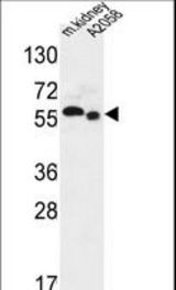 S47A2 Antibody western blot of mouse kidney tissue and A2058 cell line lysates (35 ug/lane). The S47A2 antibody detected the S47A2 protein (arrow).