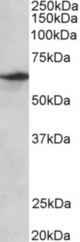 SLC47A2 antibody (0.3 ug/ml) staining of Human Testis lysate (35 ug protein in RIPA buffer). Primary incubation was 1 hour. Detected by chemiluminescence.