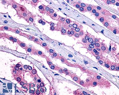 Anti-PTGER2 / EP2 antibody IHC of human kidney. Immunohistochemistry of formalin-fixed, paraffin-embedded tissue after heat-induced antigen retrieval.