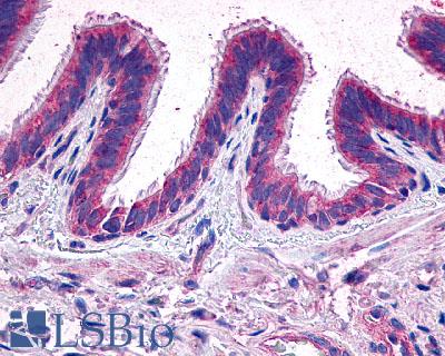 Anti-EP2 antibody LS-A971 IHC of human lung. Immunohistochemistry of formalin-fixed, paraffin-embedded tissue after heat-induced antigen retrieval.