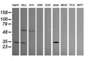 Western blot of extracts (35 ug) from 9 different cell lines by using g anti-PROSC monoclonal antibody (HepG2: human; HeLa: human; SVT2: mouse; A549: human; COS7: monkey; Jurkat: human; MDCK: canine; PC12: rat; MCF7: human).