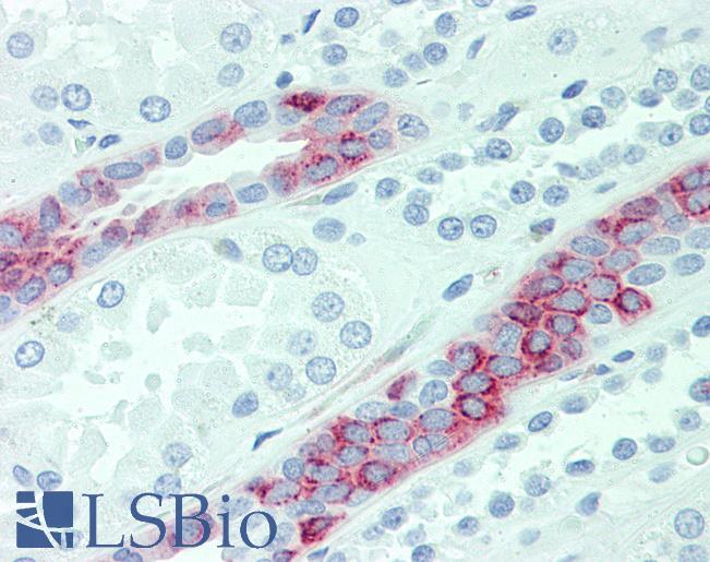Anti-SLC4A2 antibody LS-A9263 IHC of human kidney. Immunohistochemistry of formalin-fixed, paraffin-embedded tissue after heat-induced antigen retrieval.