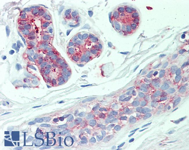 Anti-SLC4A2 antibody LS-A9263 IHC of human breast. Immunohistochemistry of formalin-fixed, paraffin-embedded tissue after heat-induced antigen retrieval.