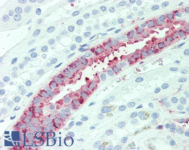 Anti-SLC4A2 antibody LS-A9261 IHC of human kidney. Immunohistochemistry of formalin-fixed, paraffin-embedded tissue after heat-induced antigen retrieval.