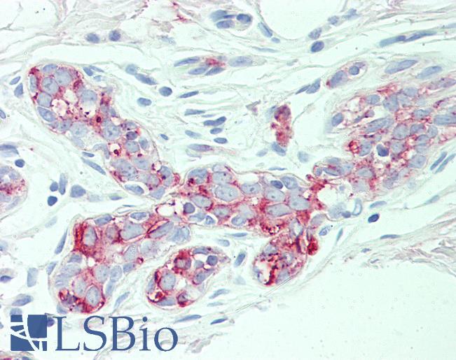 Anti-SLC4A2 antibody LS-A9261 IHC of human breast. Immunohistochemistry of formalin-fixed, paraffin-embedded tissue after heat-induced antigen retrieval.