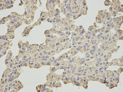 Immunohistochemistry of paraffin-embedded rat lung using SLC4A4 antibody at dilution of 1:200 (400x lens).