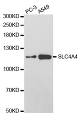 Western blot analysis of extracts of various cell lines, using SLC4A4 antibody.