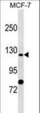 SLC4A9 Antibody western blot of MCF-7 cell line lysates (35 ug/lane). The SLC4A9 antibody detected the SLC4A9 protein (arrow).