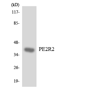 Western blot of the lysates from 293 cells using PE2R2 antibody.