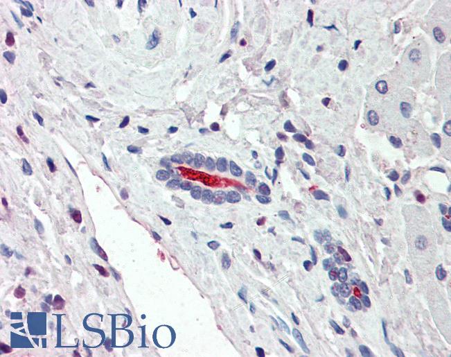 Anti-SLC5A1 / SGLT1 antibody LS-A9015 IHC of human liver. Immunohistochemistry of formalin-fixed, paraffin-embedded tissue after heat-induced antigen retrieval.