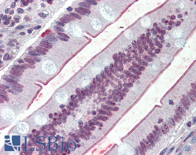 Anti-SLC5A1 / SGLT1 antibody LS-A9015 IHC of human small intestine. Immunohistochemistry of formalin-fixed, paraffin-embedded tissue after heat-induced antigen retrieval.