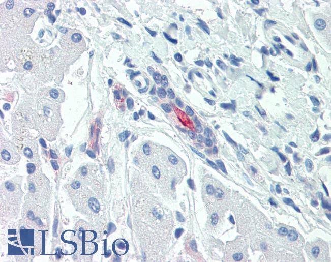 Anti-SLC5A1 / SGLT1 antibody LS-A9048 IHC of human liver. Immunohistochemistry of formalin-fixed, paraffin-embedded tissue after heat-induced antigen retrieval.
