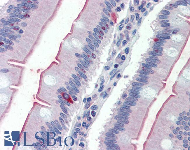 Anti-SLC5A1 / SGLT1 antibody LS-A9048 IHC of human small intestine. Immunohistochemistry of formalin-fixed, paraffin-embedded tissue after heat-induced antigen retrieval.