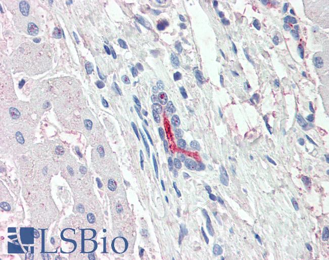 Anti-SLC5A1 / SGLT1 antibody LS-A9016 IHC of human liver. Immunohistochemistry of formalin-fixed, paraffin-embedded tissue after heat-induced antigen retrieval.