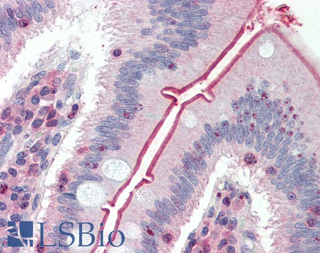 Anti-SLC5A1 / SGLT1 antibody LS-A9016 IHC of human small intestine. Immunohistochemistry of formalin-fixed, paraffin-embedded tissue after heat-induced antigen retrieval.