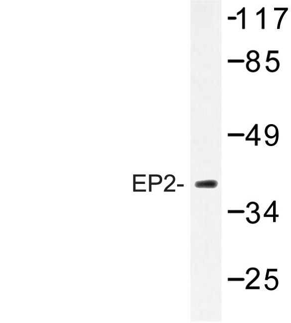 Western blot of EP2 (Q299) pAb in extracts from mouse liver.