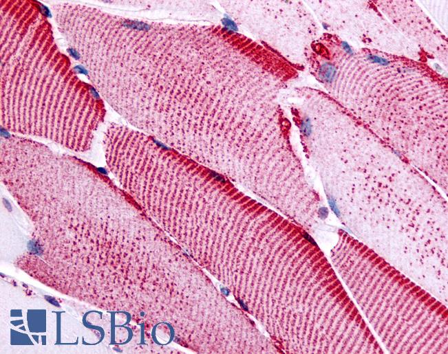Anti-SLC5A10 antibody LS-A2800 IHC of human skeletal muscle. Immunohistochemistry of formalin-fixed, paraffin-embedded tissue after heat-induced antigen retrieval.