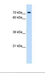 Jurkat cell lysate. Antibody concentration: 1.0 ug/ml. Gel concentration: 12%.