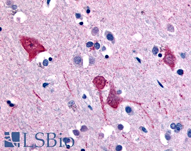 Anti-SLC5A11 antibody LS-A2797 IHC of human brain, cortex. Immunohistochemistry of formalin-fixed, paraffin-embedded tissue after heat-induced antigen retrieval.